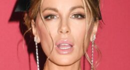 Kate Beckinsale Sues Film Producers After Injury On Set