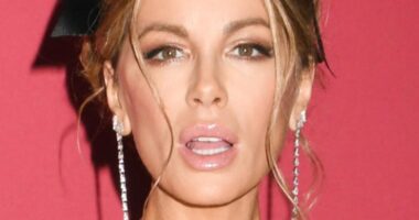 Kate Beckinsale Sues Film Producers After Injury On Set