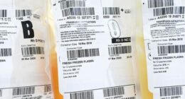 S﻿exually active gay and bisexual men will be able to donate plasma in a change of rules by Australian Red Cross Lifeblood.