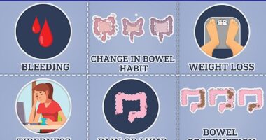 Bowel cancer can cause blood in the stool, changes in bowel habits and unexplained weight loss